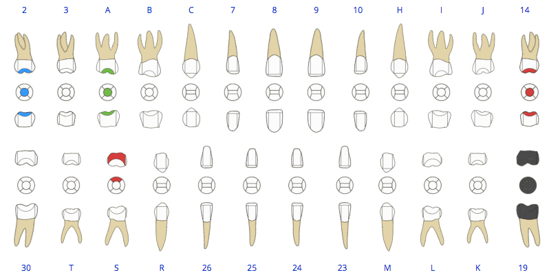 Dijital Odontogram